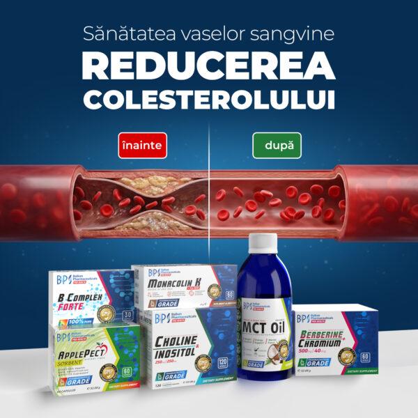 SET: Reducerea colesterolului PRO