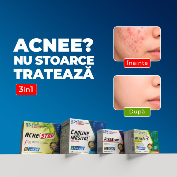 SET ACNE STOP woman