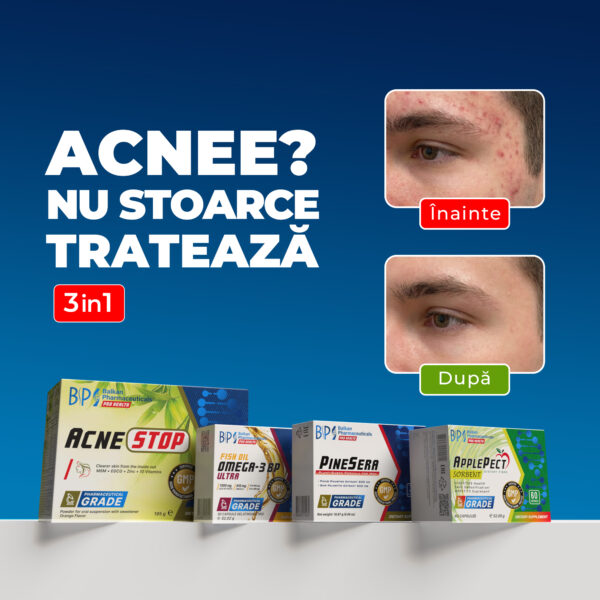 SET ACNE STOP man