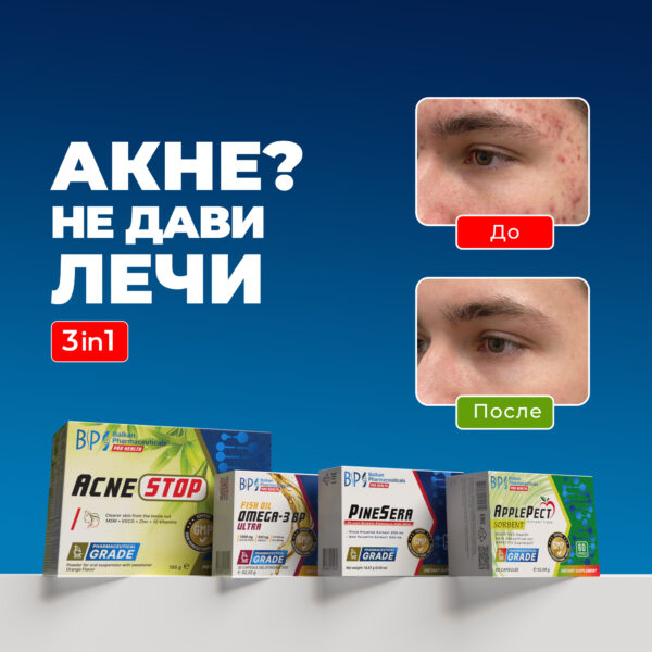 SET ACNE STOP man